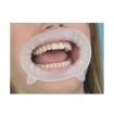 تصویر  دهان باز کن اپتراگیت ایوکلار / Ivoclar Vivadent optragate